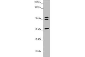 Western blot All lanes: RNF41 antibody at 5. (RNF41 antibody  (AA 1-317))