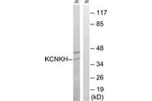 Western blot analysis of extracts from Jurkat cells, using KCNK17 Antibody.