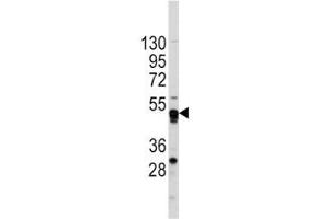 Western blot analysis of GATA4 antibody and CEM lysate. (GATA4 antibody  (AA 298-328))