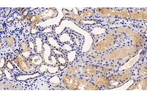 Detection of TMPRSS2 in Human Kidney Tissue using Polyclonal Antibody to Transmembrane Protease, Serine 2 (TMPRSS2) (TMPRSS2 antibody  (AA 284-492))