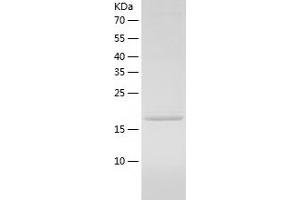 Western Blotting (WB) image for Signal Recognition Particle 14kDa (Homologous Alu RNA Binding Protein) (SRP14) (AA 1-160) protein (His tag) (ABIN7286056) (SRP14 Protein (AA 1-160) (His tag))