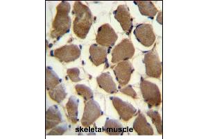 LRP3 Antibody (C-term) (ABIN390097 and ABIN2840611) immunohistochemistry analysis in formalin fixed and paraffin embedded human skeletal muscle followed by peroxidase conjugation of the secondary antibody and DAB staining. (LRP3 antibody  (C-Term))
