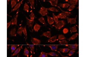 Immunofluorescence (IF) image for anti-Intersectin 2 (ITSN2) antibody (ABIN7259208)
