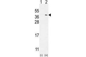 Western blot analysis of TXNDC6 (arrow) using rabbit polyclonal TXNDC6 Antibody (Center) . (NME9 antibody  (Middle Region))