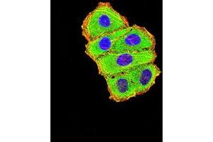 Immunofluorescence analysis of Hela cells using C3C mouse mAb (green). (Complement C3c antibody  (AA 1521-1649))