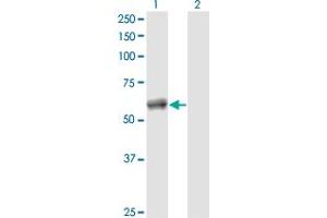 Western Blot analysis of CALCOCO2 expression in transfected 293T cell line by CALCOCO2 monoclonal antibody (M04), clone 2A11. (CALCOCO2 antibody  (AA 347-446))