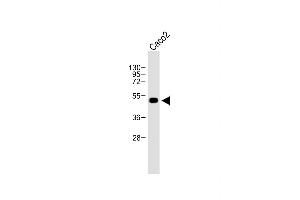 Anti-WTIP Antibody (C-term) at 1:500 dilution + Caco2 whole cell lysate Lysates/proteins at 20 μg per lane. (WTIP antibody  (AA 243-271))