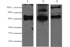 Western Blotting (WB) image for anti-Keratin 17 (KRT17) antibody (ABIN5959216) (KRT17 antibody)