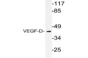 Western blot (WB) analyzes of VEGF-D antibody in extracts from COS-7 cells. (VEGFD antibody)