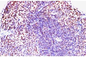 Immunohistochemistry of paraffin-embedded Mouse spleen using IFNAR1 Polyclonl Antibody at dilution of 1:200. (IFNAR1 antibody)