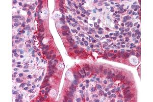 LGALS3 antibody was used for immunohistochemistry at a concentration of 4-8 ug/ml. (Galectin 3 antibody  (N-Term))