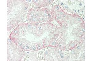 Anti-SLC3A2 / CD98 antibody IHC staining of human kidney. (SLC3A2 antibody  (AA 89-433))