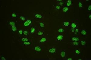 IF analysis of HAUSP/USP7 using anti-HAUSP/USP7 antibody (ABIN6719603). (USP7 antibody  (AA 258-483))