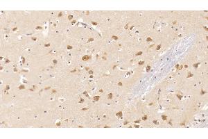 Detection of Tie1 in Human Cerebrum Tissue using Monoclonal Antibody to Tyrosine Kinase With Immunoglobulin Like And EGF Like Domains Protein 1 (Tie1) (TIE1 antibody  (AA 701-898))
