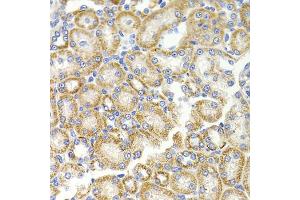 Immunohistochemistry of paraffin-embedded rat kidney using BMP15 antibody (ABIN5975746) at dilution of 1/100 (40x lens).