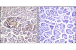 Immunohistochemistry analysis of paraffin-embedded human pancreas tissue, using Moesin/Ezrin/Radixin (Ab-558) Antibody. (Moesin/ezrin/radixin (AA 524-573) antibody)