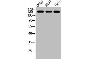 Western Blot analysis of COLO 293T HELA cells using GPR158 Polyclonal Antibody (GPR158 antibody  (N-Term))