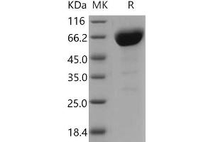 Western Blotting (WB) image for Basigin (Ok Blood Group) (BSG) (Active) protein (His tag,Fc Tag) (ABIN7320311) (CD147 Protein (His tag,Fc Tag))