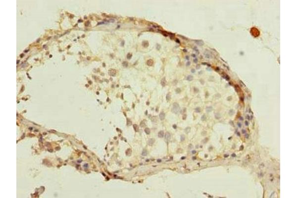 Mago Nashi Homolog 2 antibody  (AA 2-148)