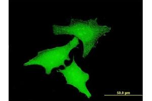 Immunofluorescence of monoclonal antibody to IL15 on HeLa cell. (IL-15 antibody  (AA 49-162))