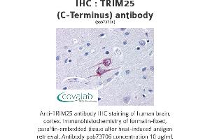 Image no. 1 for anti-Tripartite Motif Containing 25 (TRIM25) antibody (ABIN1740361) (TRIM25 antibody)