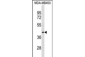 MRPL46 Antibody (C-term) (ABIN1536941 and ABIN2838174) western blot analysis in MDA-M cell line lysates (35 μg/lane). (MRPL46 antibody  (C-Term))