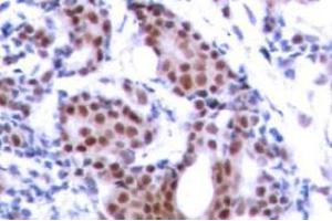 Image no. 2 for anti-ELK1, Member of ETS Oncogene Family (ELK1) (pSer383) antibody (ABIN318012) (ELK1 antibody  (pSer383))