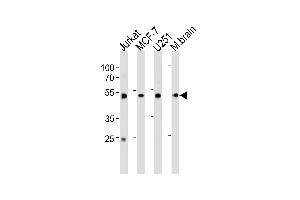 Western blot analysis in Jurkat,MCF-7,U251 cell line and mouse brain tissue lysates (35ug/lane). (ENO1 antibody  (C-Term))