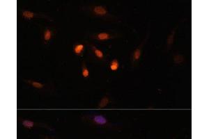 Immunofluorescence analysis of U2OS cells using KAT6A Polyclonal Antibody at dilution of 1:100. (MYST3 antibody)