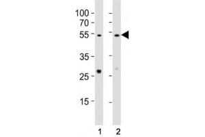 Western blot testing of EED antibody at 1:1000 dilution. (EED antibody  (AA 269-303))
