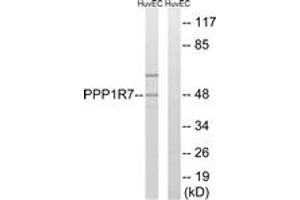 Western blot analysis of extracts from HuvEc cells, using PPP1R7 Antibody. (PPP1R7 antibody  (AA 136-185))