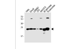 All lanes : Anti-RPL10 Antibody (N-term) at 1:4000 dilution Lane 1: Hela whole cell lysate Lane 2: Daudi whole cell lysate Lane 3: U266B1 whole cell lysate Lane 4: 293 whole cell lysate Lane 5: NIH/3T3 whole cell lysate Lane 6: Mouse pancreas lysate Lane 7: Rat pancreas lysate Lysates/proteins at 20 μg per lane. (RPL10 antibody  (N-Term))
