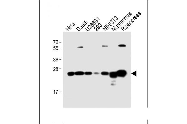 RPL10 antibody  (N-Term)