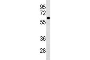 PIGS antibody western blot analysis in A549 lysate. (PIGS antibody  (AA 527-555))