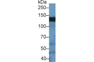 Detection of BCAR1 in Rat Testis lysate using Polyclonal Antibody to Breast Cancer Anti-Estrogen Resistance 1 (BCAR1) (BCAR1 antibody  (AA 1-240))