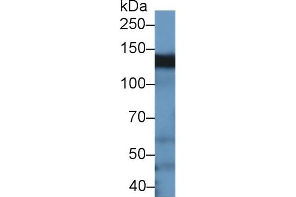 BCAR1 anticorps  (AA 1-240)