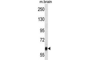 VPS45 Antibody (C-term) western blot analysis in mouse brain tissue lysates (35 µg/lane). (VPS45 antibody  (C-Term))