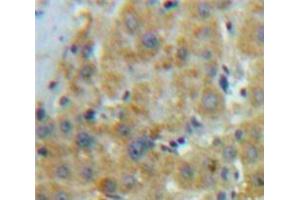 Used in DAB staining on fromalin fixed paraffin-embedded Liver tissue (APOE antibody  (AA 19-181))