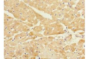 Immunohistochemistry of paraffin-embedded human heart tissue using ABIN7173550 at dilution of 1:100 (Tropomodulin 1 antibody  (AA 1-359))