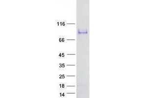 SMTNL1 Protein (Myc-DYKDDDDK Tag)