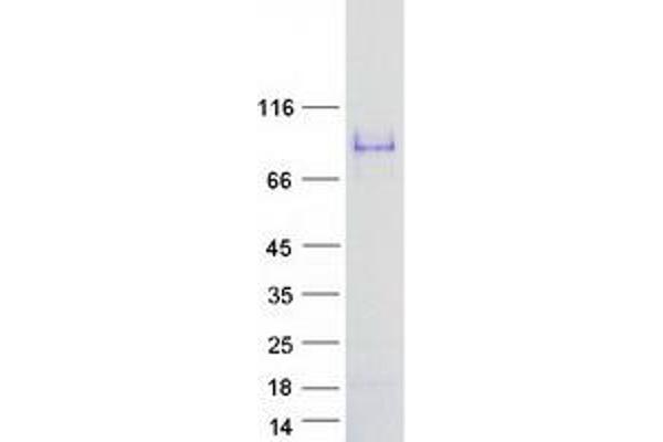 SMTNL1 Protein (Myc-DYKDDDDK Tag)
