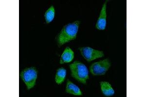 IF analysis of RPS2 using anti-RPS2 antibody (ABIN7601997). (RPS2 antibody  (AA 54-293))