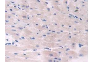 ADCY6 antibody  (AA 314-501)