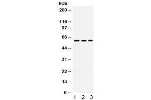 Western blot testing of human 1) A549, 2) 22RV1 and 3) U20S cell lysate with RAG2 antibody. (RAG2 antibody)