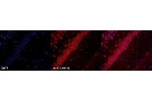 Immunohistochemistry analysis using Rabbit Anti-GRP78 Polyclonal Antibody (ABIN361824 and ABIN361825).