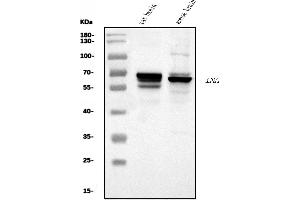 Western blot analysis of Alpha Internexin/INA using anti-Alpha Internexin/INA antibody (ABIN7602187).