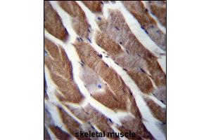 TN1 Antibody (C-term) (ABIN656749 and ABIN2845972) immunohistochemistry analysis in forlin fixed and paraffin embedded hun skeletal muscle followed by peroxidase conjugation of the secondary antibody and DAB staining.
