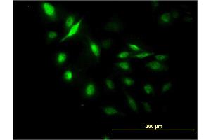 Immunofluorescence of monoclonal antibody to LUC7L on HeLa cell.
