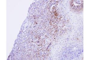 IHC-P Image Immunohistochemical analysis of paraffin-embedded Cal27 xenograft , using CACNA1S, antibody at 1:100 dilution.