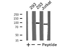 Western blot analysis of extracts from Jurkat/293 cells, using TOP1 antibody. (Topoisomerase I antibody  (Internal Region))